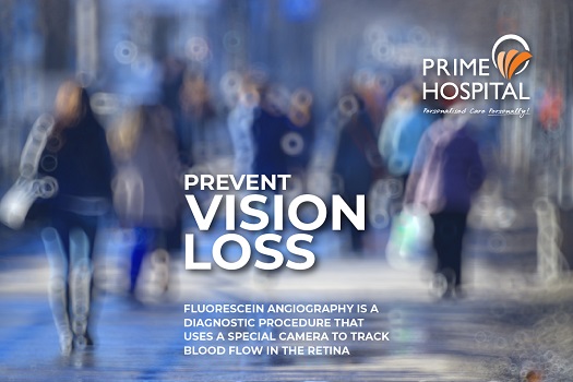Prevent Vision Loss