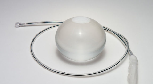 INTRAGASTRIC BALLOON SYSTEM FOR WEIGHT LOSS